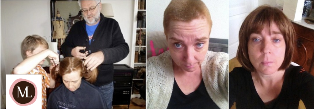 Vrouw 30+ kaal door kanker, haar afknippen