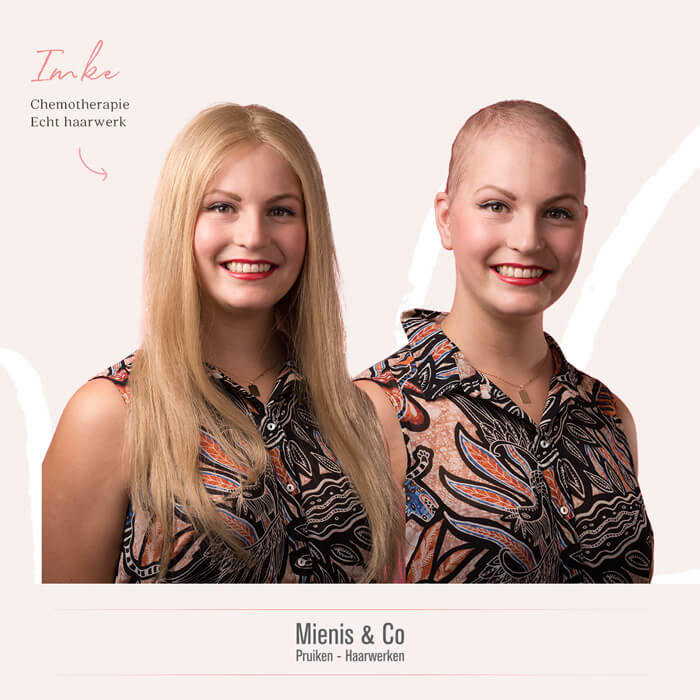 Haarverlies chemo - Pruik na Chemo
